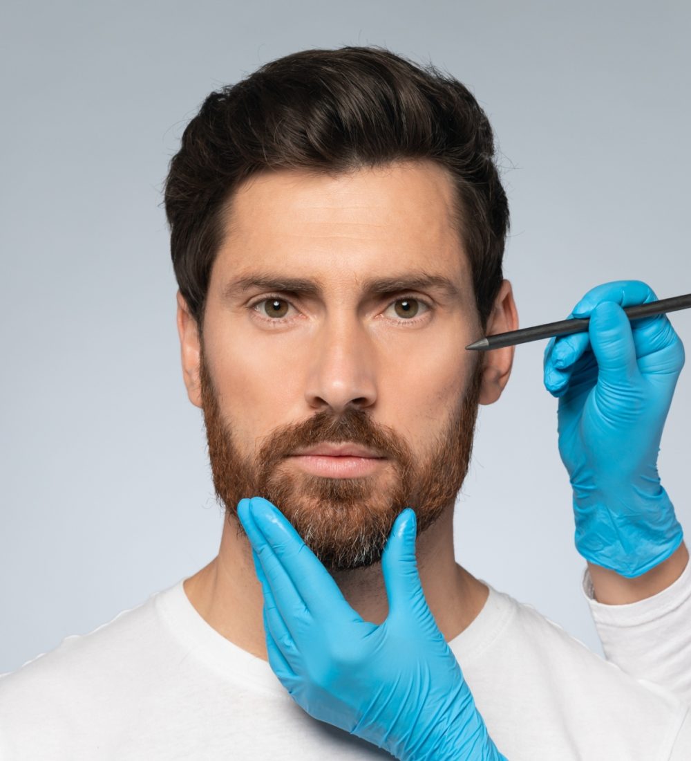 beard transplant (7) beard transplant (7)